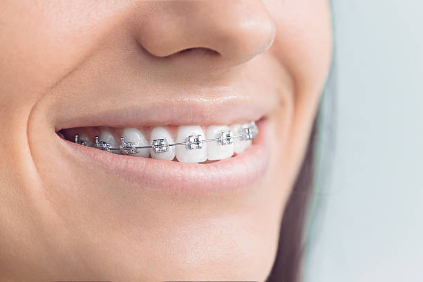 Why Choose Us for Your Dental Needs in Elmsford, NY